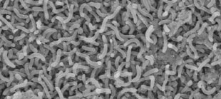 DEVILISHLY DIFFICULT: Bacteria of the clade SAR11, shown here, are among the most ubiquitous organisms in the Earth’s oceans, yet they are notoriously difficult to cultivate in the lab.