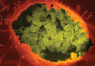 INTRACELLULAR DENIZEN: This false-color scanning electron micrograph shows the intracellular pathogen Coxiella burnetii (green) growing within a primate kidney cell (orange).