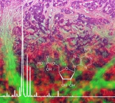 A new mass spectrometry imaging protocol allows the analysis of metabolites like adenosine monophosphate from formalin-fixed paraffin-embedded (FFPE) tissue, shown here as background. (Credit: Helmholtz Zentrum München)